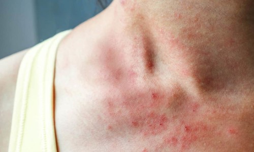 肠癌胃癌有什么症状-胃肠癌是什么症状、肠胃癌有什么症状开始 -肠胃癌有什么症状网